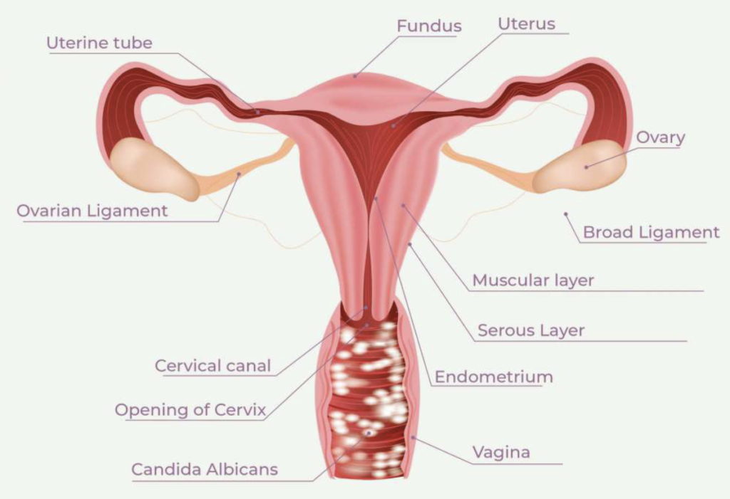 Vaginal Candida
