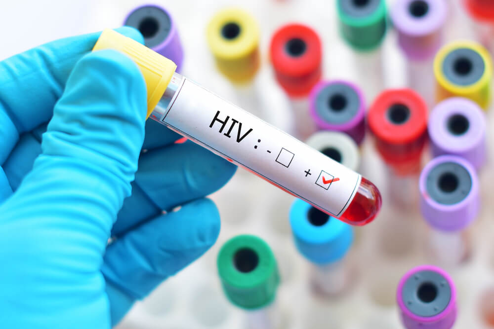Blood sample positive with HIV