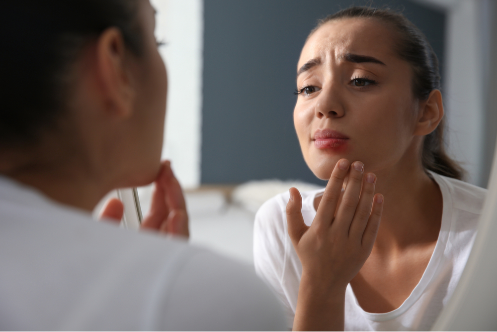 Young woman with herpes on lip
