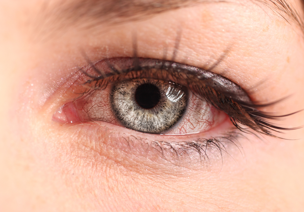 Human Eye