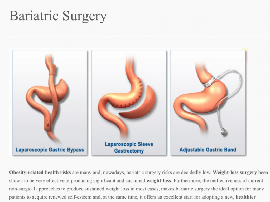 Bariatric Surgery